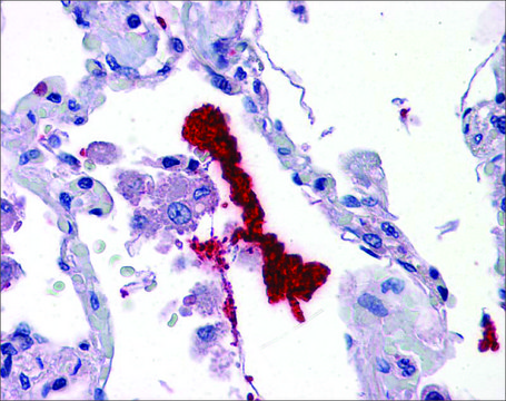 Anti-KLK6 antibody produced in rabbit affinity isolated antibody