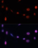 Anti-CDKN1A antibody produced in rabbit