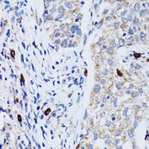 Anti-LC3B antibody produced in rabbit