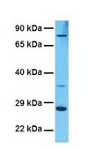 Anti-CHMP4B antibody produced in rabbit affinity isolated antibody