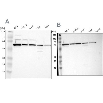 Anti-CKAP4 antibody produced in rabbit Prestige Antibodies&#174; Powered by Atlas Antibodies, affinity isolated antibody