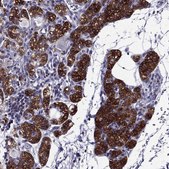 Anti-AAK1 antibody produced in rabbit Prestige Antibodies® Powered by Atlas Antibodies, affinity isolated antibody, buffered aqueous glycerol solution