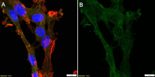 Anti-GNB1 Antibody, clone 1J8 ZooMAb&#174; Rabbit Monoclonal recombinant, expressed in HEK 293 cells