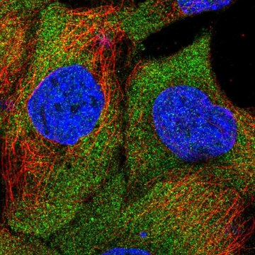 Anti-SAMD4B antibody produced in rabbit Prestige Antibodies&#174; Powered by Atlas Antibodies, affinity isolated antibody