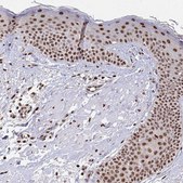 Anti-HOXA9 antibody produced in rabbit Prestige Antibodies® Powered by Atlas Antibodies, affinity isolated antibody, buffered aqueous glycerol solution