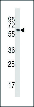 ANTI-BTN3A1 (C-TERM) antibody produced in rabbit IgG fraction of antiserum, buffered aqueous solution