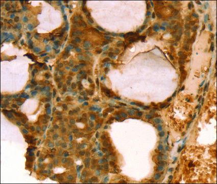 Anti-TAF11 affinity isolated antibody