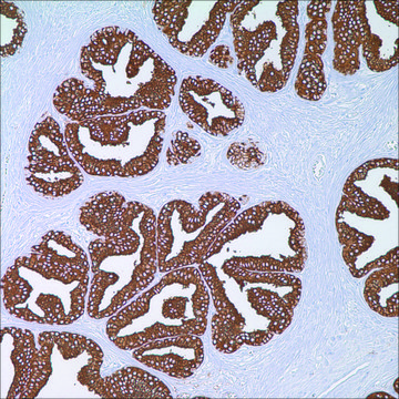 PSAP (PASE/4LJ) Mouse Monoclonal Antibody