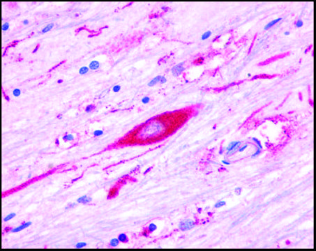 Anti-Serotonin 5-HT4 Receptor antibody produced in rabbit affinity isolated antibody