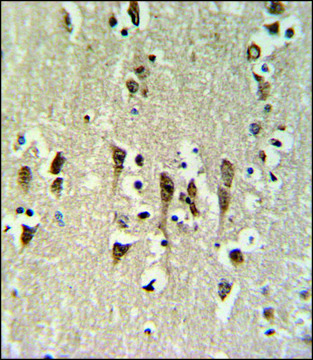 ANTI-KCTD1 (C-TERM) antibody produced in rabbit IgG fraction of antiserum, buffered aqueous solution