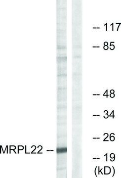 Anti-MRPL22 antibody produced in rabbit affinity isolated antibody