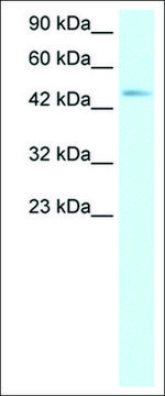 Anti-CCR8 antibody produced in rabbit IgG fraction of antiserum