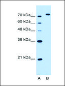 Anti-NOLC1 antibody produced in rabbit IgG fraction of antiserum