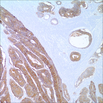 Ep-CAM/Epithelial Specific Antigen (MOC-31) Mouse Monoclonal Antibody