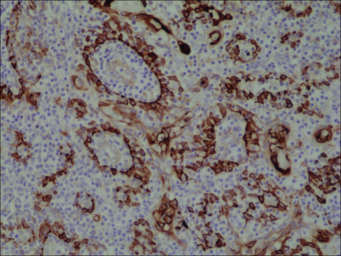 Anti-Cytokeratin 17 (CK-17) antibody, Rabbit monoclonal recombinant, expressed in HEK 293 cells, clone RM351, purified immunoglobulin