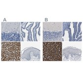 Anti-CYP2C8 antibody produced in rabbit Prestige Antibodies® Powered by Atlas Antibodies, affinity isolated antibody, buffered aqueous glycerol solution