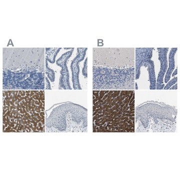 Anti-CYP2C8 antibody produced in rabbit Prestige Antibodies&#174; Powered by Atlas Antibodies, affinity isolated antibody, buffered aqueous glycerol solution