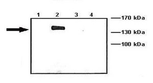Anti-ACTN2 (AB2) antibody produced in rabbit IgG fraction of antiserum