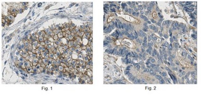 Anti-ADAM 17 Antibody, clone 16C11.1 | MABT388 clone 16C11.1, from mouse