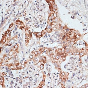 Anti-PIGR antibody produced in rabbit