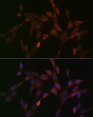 Anti-DNAJC15 Antibody, clone 7D7X7, Rabbit Monoclonal