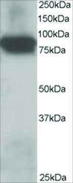 Anti-Plakoglobin/&#947;-Catenin antibody produced in goat affinity isolated antibody, buffered aqueous solution