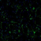 Anti-ECH1 antibody produced in rabbit Prestige Antibodies® Powered by Atlas Antibodies, affinity isolated antibody, buffered aqueous glycerol solution