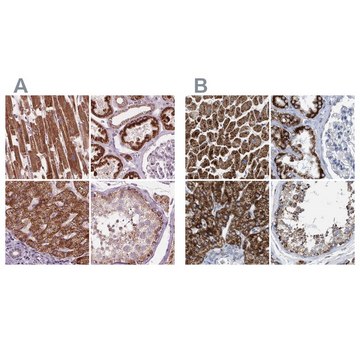 Anti-ECI2 antibody produced in rabbit Prestige Antibodies® Powered by Atlas Antibodies, affinity isolated antibody, buffered aqueous glycerol solution