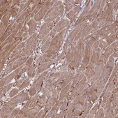 Anti-VRK2 antibody produced in rabbit Prestige Antibodies® Powered by Atlas Antibodies, affinity isolated antibody, buffered aqueous glycerol solution