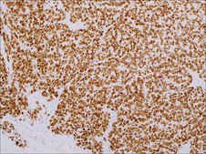NKX2.2 (EP336) Rabbit Monoclonal Primary Antibody