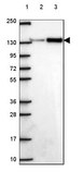 Anti-SMC2 antibody produced in rabbit Prestige Antibodies® Powered by Atlas Antibodies, affinity isolated antibody, buffered aqueous glycerol solution