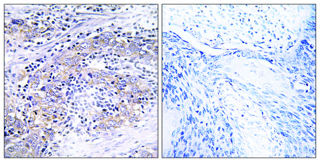 Anti-CLN6 antibody produced in rabbit affinity isolated antibody