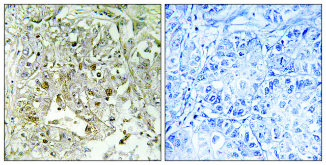 Anti-p38 MAPK antibody produced in rabbit affinity isolated antibody