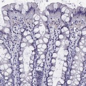 Anti-CFAP70 Prestige Antibodies® Powered by Atlas Antibodies, affinity isolated antibody