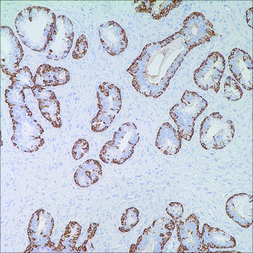 Cytokeratin (34betaE12) Mouse Monoclonal Antibody