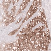 Monoclonal Anti-GPR88 antibody produced in mouse Prestige Antibodies® Powered by Atlas Antibodies, clone CL15190, purified antibody (Protein A)