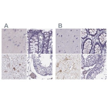 Anti-CALCR antibody produced in rabbit Prestige Antibodies&#174; Powered by Atlas Antibodies, affinity isolated antibody