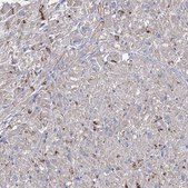 Anti-NRAP antibody produced in rabbit Prestige Antibodies® Powered by Atlas Antibodies, affinity isolated antibody, buffered aqueous glycerol solution