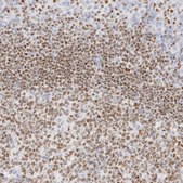 Anti-IKZF3 antibody produced in rabbit Prestige Antibodies® Powered by Atlas Antibodies, affinity isolated antibody, buffered aqueous glycerol solution