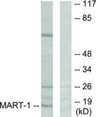 Anti-MART-1 antibody produced in rabbit affinity isolated antibody