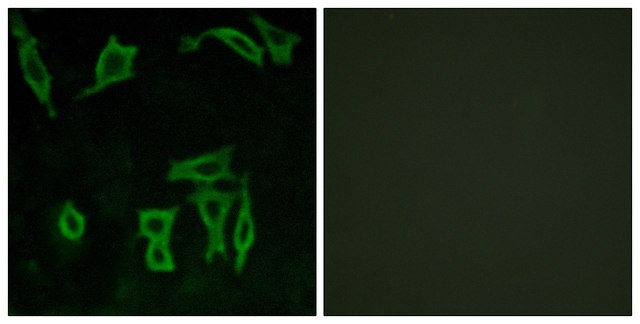 Anti-GRM5 antibody produced in rabbit affinity isolated antibody