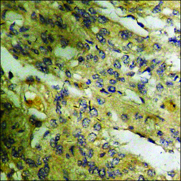 Anti-phospho-HDAC5 (pSer259) antibody produced in rabbit affinity isolated antibody