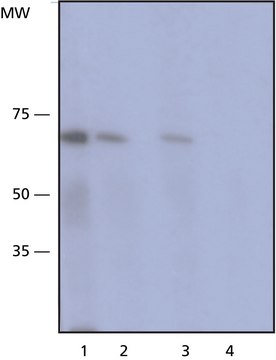 Monoclonal Anti-Tyrosinase antibody produced in mouse clone T311, purified immunoglobulin, buffered aqueous solution