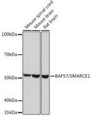 Anti-BAF57/SMARCE1 Antibody, clone 9L5F6, Rabbit Monoclonal