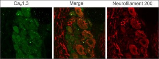 Anti-Calcium Channel (&#945;1D Subunit) (L-type of Voltage-gated Ca2+ Channel) antibody produced in rabbit affinity isolated antibody, lyophilized powder