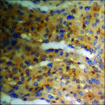 抗-磷酸化-PKA CAT (pThr197) 兔抗 affinity isolated antibody