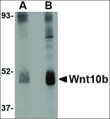 Anti-Wnt10B antibody produced in rabbit affinity isolated antibody, buffered aqueous solution
