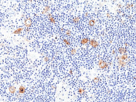 Anti-CD30 Rabbit Monoclonal Antibody clone RM425, affinity purified immunoglobulin