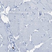 Anti-S100P antibody produced in rabbit Prestige Antibodies® Powered by Atlas Antibodies, affinity isolated antibody, buffered aqueous glycerol solution