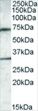 Anti-Endothelial Lipase antibody produced in goat affinity isolated antibody, buffered aqueous solution